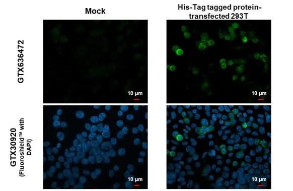 Anti-6x His Tag antibody [GT636] (GTX636472) | GeneTex