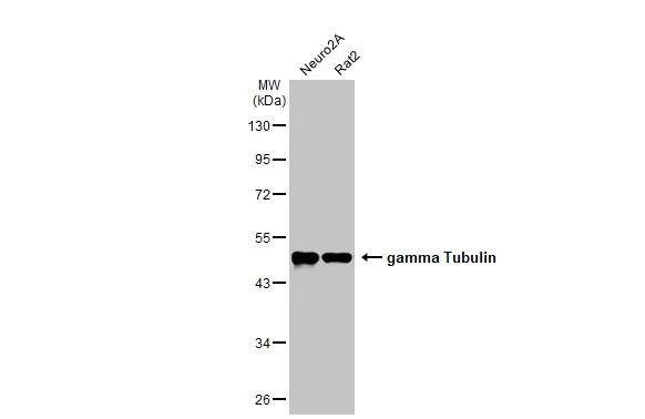 Various whole cell extracts (30 μg) were separated by 10% SDS-PAGE, and the membrane was blotted with gamma Tubulin antibody [HL1175] (GTX636480) diluted at 1:10000. The HRP-conjugated anti-rabbit IgG antibody (GTX213110-01) was used to detect the primary antibody.
