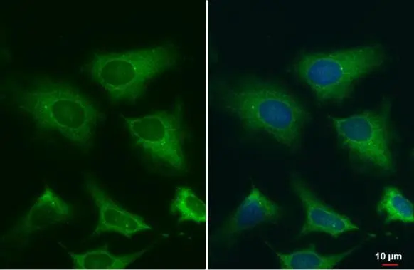 gamma Tubulin antibody [HL1175] detects gamma Tubulin protein at centrosome and mitochondria by immunofluorescent analysis. Sample: HeLa cells were fixed in ice-cold MeOH for 5 min. Green: gamma Tubulin stained by gamma Tubulin antibody [HL1175] (GTX636480) diluted at 1:2500. Blue: Fluoroshield with DAPI (GTX30920).