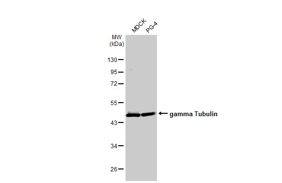 Various whole cell extracts (30 μg) were separated by 10% SDS-PAGE, and the membrane was blotted with gamma Tubulin antibody [HL1175] (GTX636480) diluted at 1:5000. The HRP-conjugated anti-rabbit IgG antibody (GTX213110-01) was used to detect the primary antibody.