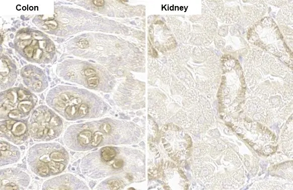 Anti-PARP14 antibody [HL1178] (GTX636483) | GeneTex