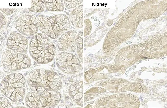 PARP14 antibody [HL1178] detects PARP14 protein by immunohistochemical analysis. Sample: Paraffin-embedded rat tissue. PARP14 stained by PARP14 antibody [HL1178] (GTX636483) diluted at 1:100. Antigen Retrieval: Citrate buffer, pH 6.0, 15 min