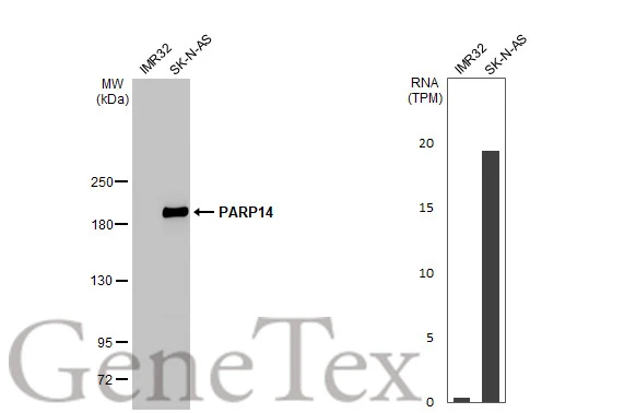Various whole cell extracts (30 μg) were separated by 5% SDS-PAGE, and the membrane was blotted with PARP14 antibody [HL1178] (GTX636483) diluted at 1:1000. The HRP-conjugated anti-rabbit IgG antibody (GTX213110-01) was used to detect the primary antibody. Corresponding RNA expression data for the same cell lines are based on Human Protein Atlas program.
