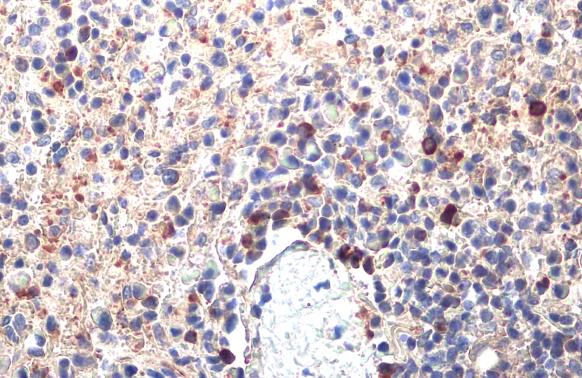 PARP14 antibody [HL1180]