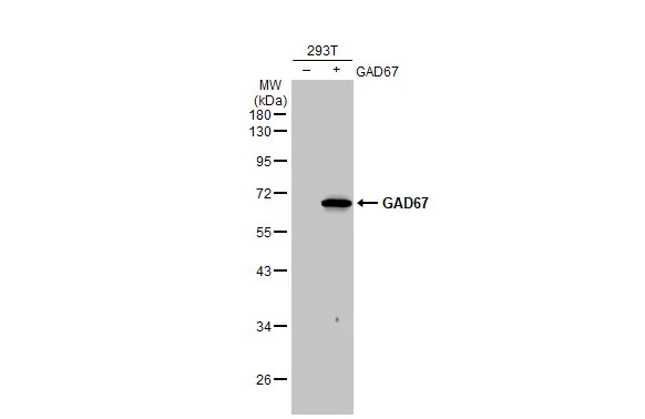 Anti-GAD65 + GAD67 antibody [HL1181] (GTX636487) | GeneTex