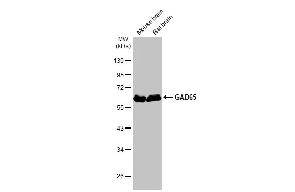 GAD65 antibody [HL1187]