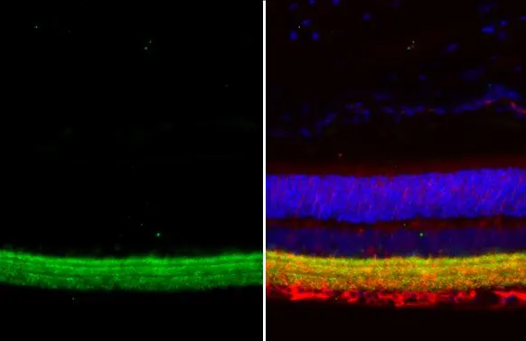 GAD65 antibody [HL1187]