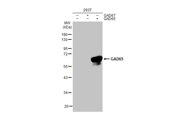 GAD65 antibody [HL1187]