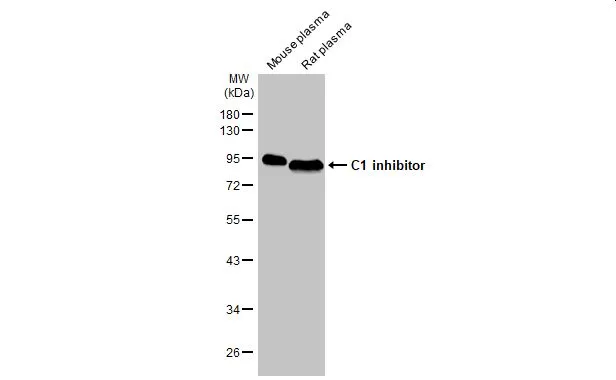 Mouse plasma and rat plasma (30 μg) were separated by 10% SDS-PAGE, and the membrane was blotted with C1 inhibitor antibody [HL1196] (GTX636508) diluted at 1:2000. The HRP-conjugated anti-rabbit IgG antibody (GTX213110-01) was used to detect the primary antibody.