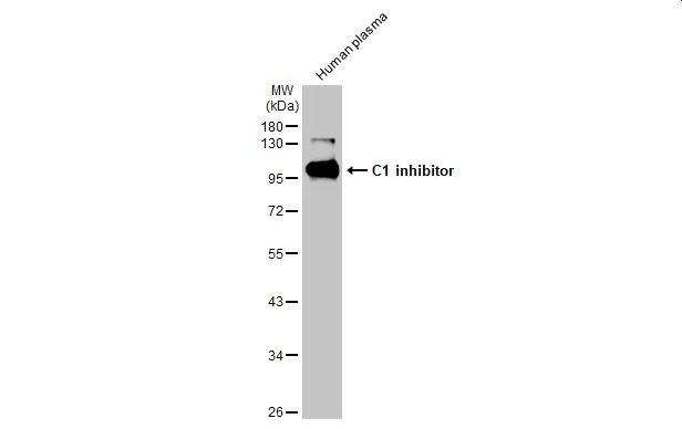 Human plasma (30 μg) was separated by 10% SDS-PAGE, and the membrane was blotted with C1 inhibitor antibody [HL1196] (GTX636508) diluted at 1:10000. The HRP-conjugated anti-rabbit IgG antibody (GTX213110-01) was used to detect the primary antibody.
