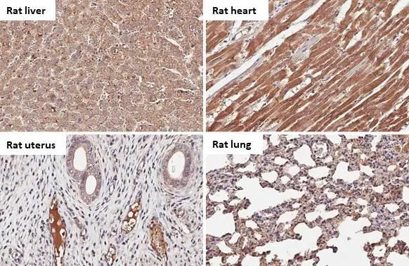 C1 inhibitor antibody [HL1196] detects C1 inhibitor protein by immunohistochemical analysis. Sample: Paraffin-embedded rat tissues. C1 inhibitor stained by C1 inhibitor antibody [HL1196] (GTX636508) diluted at 1:100. Antigen Retrieval: Citrate buffer, pH 6.0, 15 min