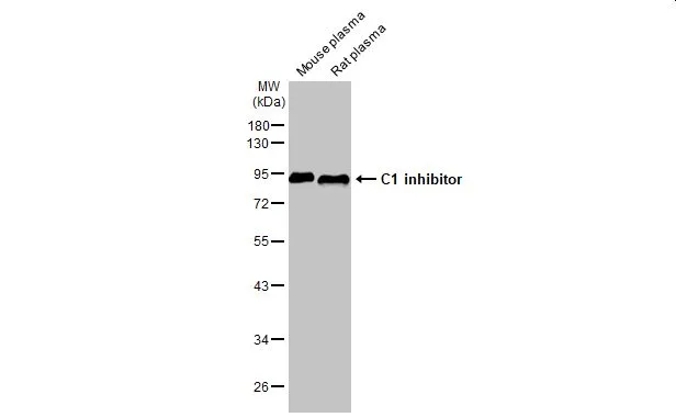 Mouse plasma and rat plasma (30 μg) were separated by 10% SDS-PAGE, and the membrane was blotted with C1 inhibitor antibody [HL1197] (GTX636509) diluted at 1:1000. The HRP-conjugated anti-rabbit IgG antibody (GTX213110-01) was used to detect the primary antibody.