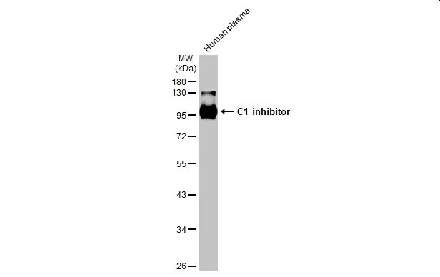 Human plasma (30 μg) was separated by 10% SDS-PAGE, and the membrane was blotted with C1 inhibitor antibody [HL1197] (GTX636509) diluted at 1:5000. The HRP-conjugated anti-rabbit IgG antibody (GTX213110-01) was used to detect the primary antibody.
