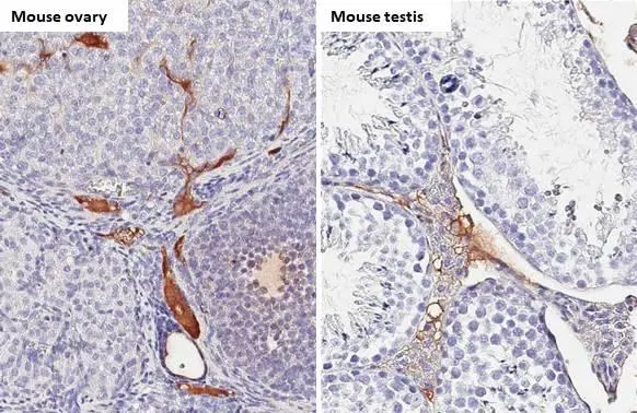 C1 inhibitor antibody [HL1197] detects C1 inhibitor protein by immunohistochemical analysis. Sample: Paraffin-embedded mouse tissues. C1 inhibitor stained by C1 inhibitor antibody [HL1197] (GTX636509) diluted at 1:100. Antigen Retrieval: Citrate buffer, pH 6.0, 15 min