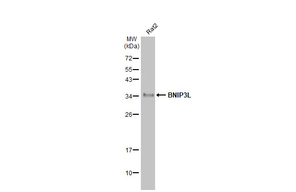 Whole cell extract (30 μg) was separated by 12% SDS-PAGE, and the membrane was blotted with BNIP3L antibody [HL1203] (GTX636515) diluted at 1:1000. The HRP-conjugated anti-rabbit IgG antibody (GTX213110-01) was used to detect the primary antibody.