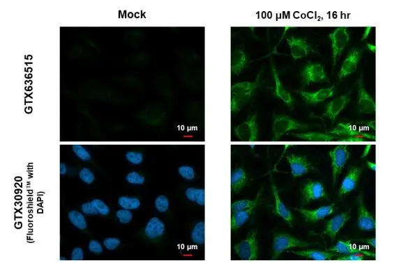 BNIP3L antibody [HL1203] detects BNIP3L protein at mitochondria by immunofluorescent analysis. Sample: Mock and treated HeLa cells were fixed in 4% paraformaldehyde at RT for 15 min. Green: BNIP3L stained by BNIP3L antibody [HL1203] (GTX636515) diluted at 1:500. Blue: Fluoroshield with DAPI (GTX30920).