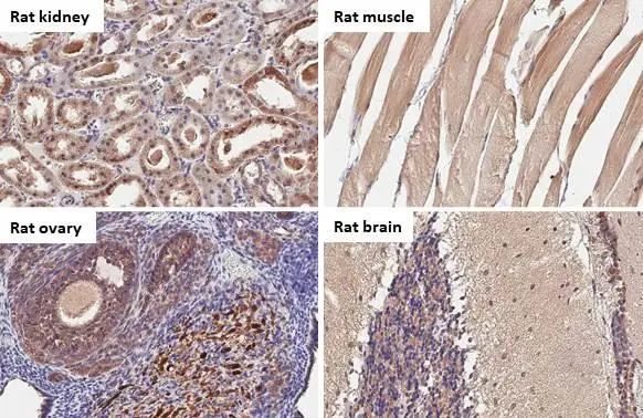 BNIP3L antibody [HL1203] detects BNIP3L protein by immunohistochemical analysis. Sample: Paraffin-embedded rat tissues. BNIP3L stained by BNIP3L antibody [HL1203] (GTX636515) diluted at 1:100. Antigen Retrieval: Citrate buffer, pH 6.0, 15 min