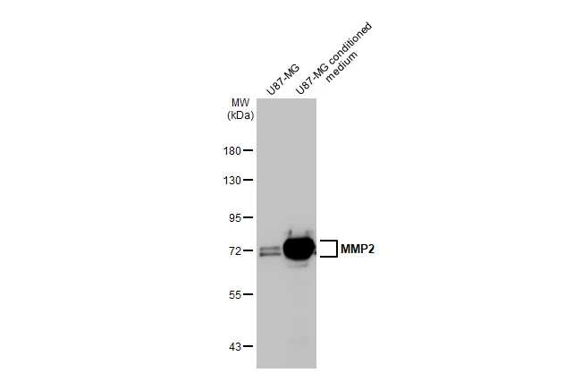 U87-MG whole cell extract and conditioned medium (30 μg) were separated by 7.5% SDS-PAGE, and the membrane was blotted with MMP2 antibody [HL1207] (GTX636524) diluted at 1:1000. The HRP-conjugated anti-rabbit IgG antibody (GTX213110-01) was used to detect the primary antibody.