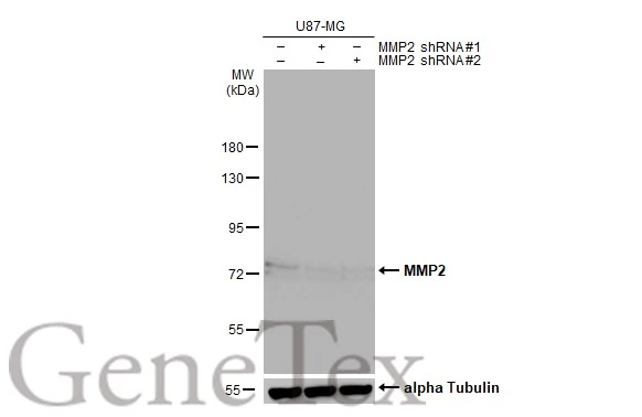 Non-transfected (–) and transfected (+) U87-MG whole cell extracts (50 μg) were separated by 7.5% SDS-PAGE, and the membrane was blotted with MMP2 antibody [HL1207] (GTX636524) diluted at 1:1000. The HRP-conjugated anti-rabbit IgG antibody (GTX213110-01) was used to detect the primary antibody, and the signal was developed with Trident ECL plus-Enhanced.