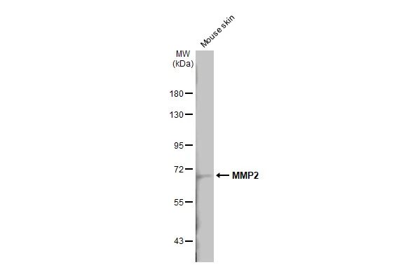 Mouse tissue extracts (50 μg) was separated by 7.5% SDS-PAGE, and the membrane was blotted with MMP2 antibody [HL1207] (GTX636524) diluted at 1:1000. The HRP-conjugated anti-rabbit IgG antibody (GTX213110-01) was used to detect the primary antibody, and the signal was developed with Trident ECL plus-Enhanced.