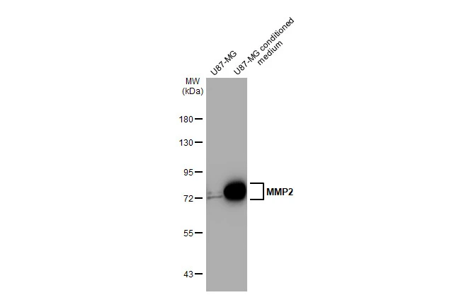 U87-MG whole cell extract and conditioned medium (30 μg) were separated by 7.5% SDS-PAGE, and the membrane was blotted with MMP2 antibody [HL1208] (GTX636525) diluted at 1:1000. The HRP-conjugated anti-rabbit IgG antibody (GTX213110-01) was used to detect the primary antibody.