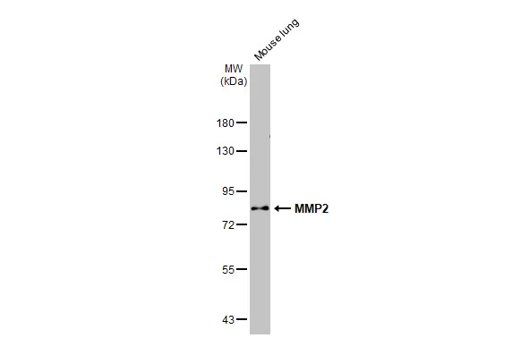 Mouse tissue extracts (50 μg) was separated by 7.5% SDS-PAGE, and the membrane was blotted with MMP2 antibody [HL1208] (GTX636525) diluted at 1:1000. The HRP-conjugated anti-rabbit IgG antibody (GTX213110-01) was used to detect the primary antibody, and the signal was developed with Trident ECL plus-Enhanced.