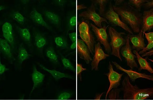 DUT antibody [HL1210] detects DUT protein at cytoplasm, nucleus and centrosome by immunofluorescent analysis. Sample: HeLa cells were fixed in 4% paraformaldehyde at RT for 15 min. Green: DUT stained by DUT antibody [HL1210] (GTX636527) diluted at 1:500. Red: alpha Tubulin, a cytoskeleton marker, stained by alpha Tubulin antibody [GT114] (GTX628802) diluted at 1:1000.
