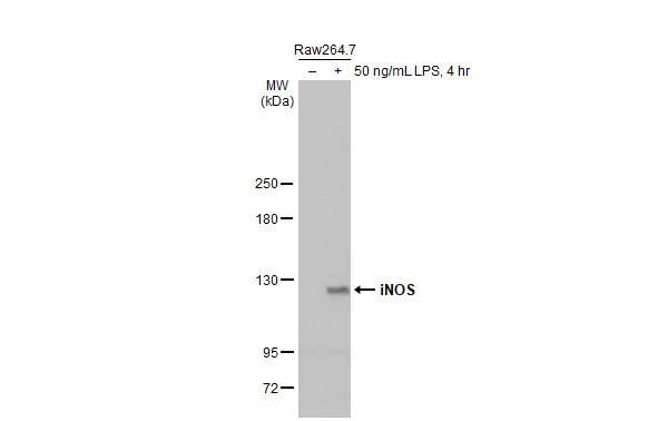 Untreated (–) and treated (+) Raw264.7 whole cell extracts (30 μg) were separated by 5% SDS-PAGE, and the membrane was blotted with iNOS antibody [HL1213] (GTX636531) diluted at 1:1000. The HRP-conjugated anti-rabbit IgG antibody (GTX213110-01) was used to detect the primary antibody.