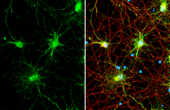 iNOS antibody [HL1213] detects iNOS protein by immunofluorescent analysis. Sample: DIV9 rat cortical neuron and Glia cell cells were fixed in 4% paraformaldehyde at RT for 15 min. Green: iNOS stained by iNOS antibody [HL1213] (GTX636531) diluted at 1:2500. Red: Tau, an axon marker, stained by Tau antibody [GT287] (GTX634809) diluted at 1:500. Blue: Fluoroshield with DAPI (GTX30920).