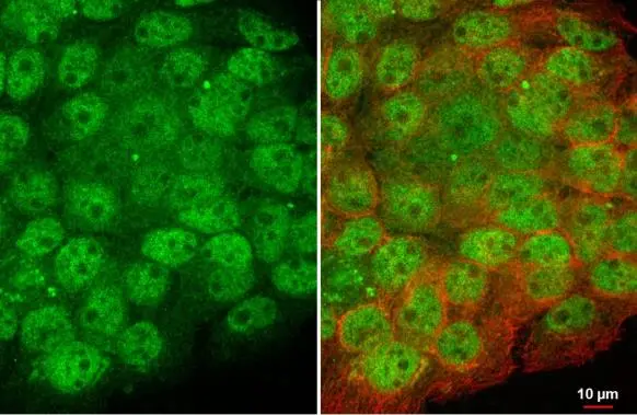 Artemis antibody [HL1227] detects Artemis protein at nucleus by immunofluorescent analysis. Sample: A431 cells were fixed in 4% paraformaldehyde at RT for 15 min. Green: Artemis stained by Artemis antibody [HL1227] (GTX636575) diluted at 1:500. Red: alpha Tubulin, a cytoskeleton marker, stained by alpha Tubulin antibody [GT114] (GTX628802) diluted at 1:1000.