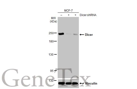 Non-transfected (–) and transfected (+) MCF-7 whole cell extracts (30 μg) were separated by 5% SDS-PAGE, and the membrane was blotted with Dicer antibody [HL1232] (GTX636580) diluted at 1:1000. The HRP-conjugated anti-rabbit IgG antibody (GTX213110-01) was used to detect the primary antibody.