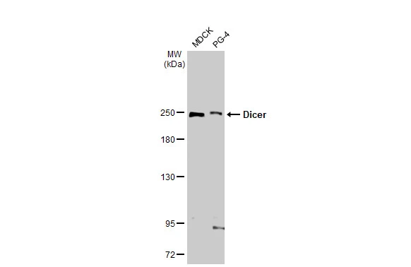 Various whole cell extracts (30 μg) were separated by 5% SDS-PAGE, and the membrane was blotted with Dicer antibody [HL1232] (GTX636580) diluted at 1:1000. The HRP-conjugated anti-rabbit IgG antibody (GTX213110-01) was used to detect the primary antibody.