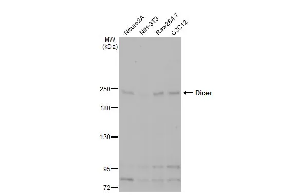 Various whole cell extracts (30 μg) were separated by 5% SDS-PAGE, and the membrane was blotted with Dicer antibody [HL1232] (GTX636580) diluted at 1:1000. The HRP-conjugated anti-rabbit IgG antibody (GTX213110-01) was used to detect the primary antibody, and the signal was developed with Trident ECL plus-Enhanced.