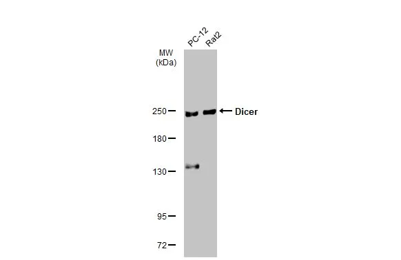 Various whole cell extracts (30 μg) were separated by 5% SDS-PAGE, and the membrane was blotted with Dicer antibody [HL1232] (GTX636580) diluted at 1:1000. The HRP-conjugated anti-rabbit IgG antibody (GTX213110-01) was used to detect the primary antibody, and the signal was developed with Trident ECL plus-Enhanced.