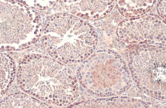 Dicer antibody [HL1232] detects Dicer protein at cytoplasm by immunohistochemical analysis. Sample: Paraffin-embedded mouse testis. Dicer stained by Dicer antibody [HL1232] (GTX636580) diluted at 1:500. Antigen Retrieval: Citrate buffer, pH 6.0, 15 min