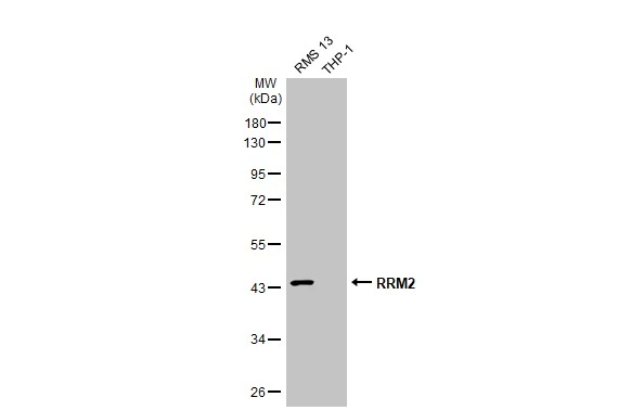 Various whole cell extracts (30 μg) were separated by 10% SDS-PAGE, and the membrane was blotted with RRM2 antibody [HL1235] (GTX636634) diluted at 1:1000. The HRP-conjugated anti-rabbit IgG antibody (GTX213110-01) was used to detect the primary antibody. Corresponding RNA expression data for the same cell lines are based on Human Protein Atlas program.