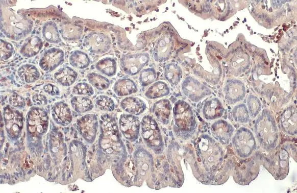 RRM2 antibody [HL1235] detects RRM2 protein at cytoplasm by immunohistochemical analysis. Sample: Paraffin-embedded mouse colon. RRM2 stained by RRM2 antibody [HL1235] (GTX636634) diluted at 1:100. Antigen Retrieval: Citrate buffer, pH 6.0, 15 min