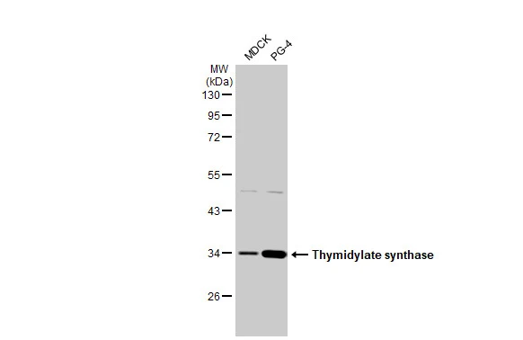 Thymidylate synthase antibody [HL1236]