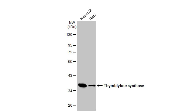 Anti-Thymidylate synthase antibody [HL1236] (GTX636635) | GeneTex