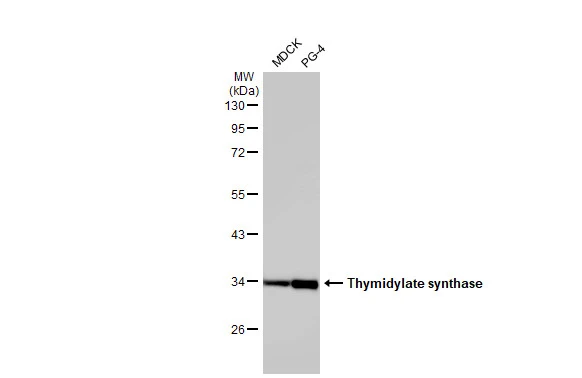 Thymidylate synthase antibody [HL1237]