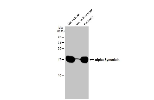 Various tissue extracts (50 μg) were separated by 15% SDS-PAGE, and the membrane was blotted with alpha Synuclein antibody [HL1242] (GTX636641) diluted at 1:1000. The HRP-conjugated anti-rabbit IgG antibody (GTX213110-01) was used to detect the primary antibody.