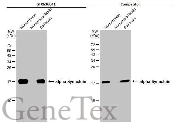 Various tissue extracts (50 μg) were separated by 15% SDS-PAGE, and the membranes were blotted with alpha Synuclein antibody [HL1242] (GTX636641) diluted at 1:1000 and competitor's antibody (Competitor) diluted at 1:1000. The HRP-conjugated anti-rabbit IgG antibody (GTX213110-01) was used to detect the primary antibody. *The competitor is not affiliated with GeneTex and does not endorse this product.