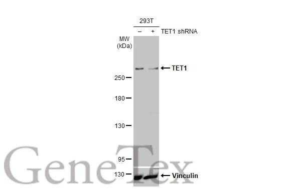 Non-transfected (–) and transfected (+) 293T whole cell extracts (30 μg) were separated by 5% SDS-PAGE, and the membrane was blotted with TET1 antibody [GT1382] (GTX636643) diluted at 1:2000. The HRP-conjugated anti-mouse IgG antibody (GTX213111-01) was used to detect the primary antibody.