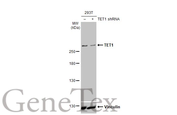 Non-transfected (–) and transfected (+) 293T whole cell extracts (30 μg) were separated by 5% SDS-PAGE, and the membrane was blotted with TET1 antibody [GT231] (GTX636644) diluted at 1:3000. The HRP-conjugated anti-mouse IgG antibody (GTX213111-01) was used to detect the primary antibody.