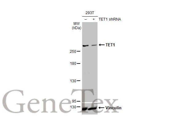 Non-transfected (–) and transfected (+) 293T whole cell extracts (30 μg) were separated by 5% SDS-PAGE, and the membrane was blotted with TET1 antibody [GT2457] (GTX636645) diluted at 1:5000. The HRP-conjugated anti-mouse IgG antibody (GTX213111-01) was used to detect the primary antibody.