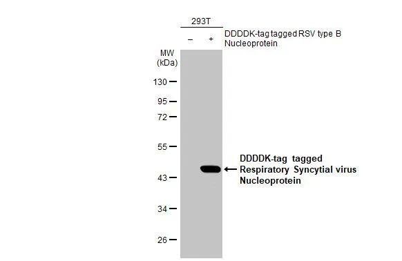 Non-transfected (–) and transfected (+) 293T whole cell extracts (30 μg) were separated by 10% SDS-PAGE, and the membrane was blotted with Respiratory Syncytial virus Nucleoprotein antibody [HL1245] (GTX636647) diluted at 1:5000. The HRP-conjugated anti-rabbit IgG antibody (GTX213110-01) was used to detect the primary antibody.