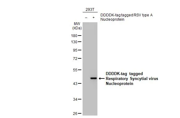 Non-transfected (–) and transfected (+) 293T whole cell extracts (30 μg) were separated by 10% SDS-PAGE, and the membrane was blotted with Respiratory Syncytial virus Nucleoprotein antibody [HL1245] (GTX636647) diluted at 1:5000. The HRP-conjugated anti-rabbit IgG antibody (GTX213110-01) was used to detect the primary antibody.