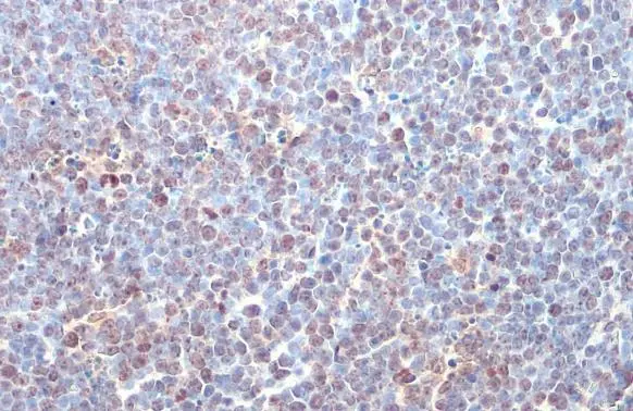 ITK antibody [HL1264]