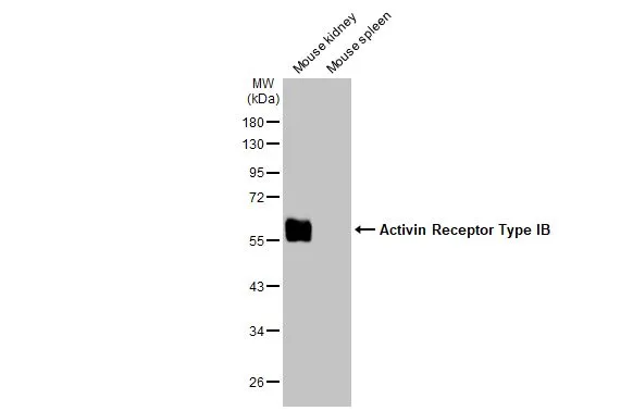 Various tissue extracts (30 μg) were separated by 10% SDS-PAGE, and the membrane was blotted with Activin Receptor Type IB antibody [HL1266] (GTX636668) diluted at 1:1000. The HRP-conjugated anti-rabbit IgG antibody (GTX213110-01) was used to detect the primary antibody, and the signal was developed with Trident ECL plus-Enhanced.