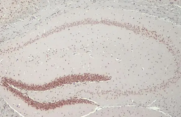 NFIX antibody [HL1269]